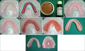 A little more care is required as to not damage the soft liner. Fabrication And Relining Of Dentures With Permanent Silicone Soft Liner A Novel Way To Increase Retention In Grossly Resorbed Ridge And Minimize Trauma Of Knife Edge And Severe Undercuts Ridges Singh K