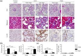 When unknown, a variable must be set as 'not available' and will be considered normal. Differential Synchrotron X Ray Imaging Markers Based On The Renal Microvasculature For Tubulointerstitial Lesions And Glomerulopathy Scientific Reports