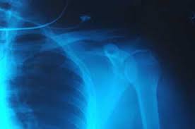 The average salary for a x ray tech is $64,405 per year in new york city, ny area. How X Rays Work Howstuffworks