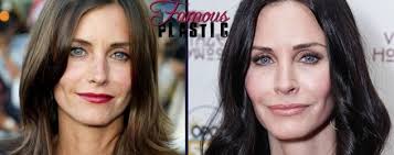 Gone are the days when you could spot somebody who had plastic surgery procedures with ease. Pin On Plastic Surgury Reminder