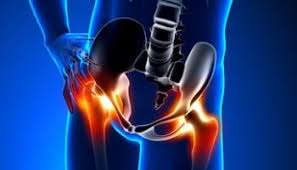 Hanche Chirurgie Orthopedique Et Traumatologie A Rennes