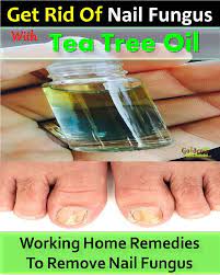 Nail Fungus Tea Tree Oil For Nail Fungus How To Get Rid Of Nail Fungus With Tea Tree Oil 21 Home Remedies For Nagelpilz Hausmittel Nagelpilz Zehennagelpilz