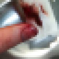 Schnittwunden im finger gehören zu den ärgernissen des alltags. Inhaltswarnung Haushaltsunfall Fotos Von Daumenkuppe