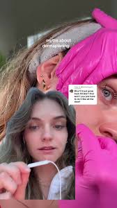 How Does Hair Grow Back After Dermaplaning Face at Home