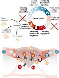 Maybe you would like to learn more about one of these? The Hallmarks Of Cancer Are Also The Hallmarks Of Wound Healing Science Signaling