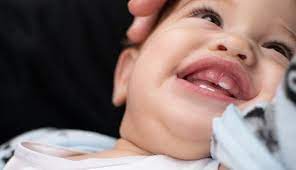 Zahnen Die Ersten Zahne Beim Baby
