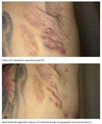 11th EHSF Conference 2022 Abstracts