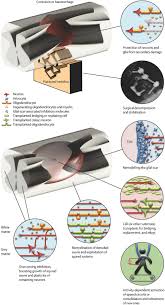 The antimatter relay comes in three tiers. Combinatorial Therapies After Spinal Cord Injury How Can Biomaterials Help Fuhrmann 2017 Advanced Healthcare Materials Wiley Online Library