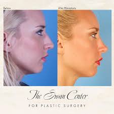They help their atlanta cosmetic surgery patients achieve a natural, yet enhanced appearance. Whether You Are The Swan Center For Plastic Surgery Facebook