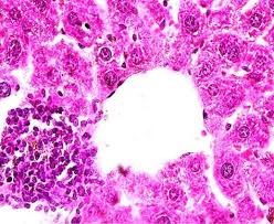 Image result for Gnidia stenophylla