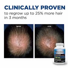Hair growth vitamins with biotin. Buy Minoxidin 1000mg Hair Growth Supplement Extra Strength Hair Growth Pills Biotin Beta Sitosterol Minoxidil Dht Blocker 5 For Men Women 60 Pills Online In Vietnam 609841818