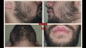 I went back later in the week and asked for a full head shave, he said no. Minoxidil Beard 7 Months Progress Slideshow Update Youtube