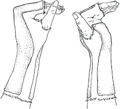 We did not find results for: Basic Principles Of Splinting In The Emergency Department Chapter 14 Sports Medicine For The Emergency Physician