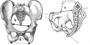 Image result for Pelvimetry