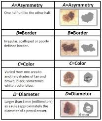 Psoriasis is a skin condition that causes itchy, inflamed, and scaly patches. Melanoma Symptoms Moffitt