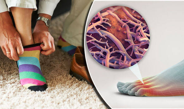 Image result for side effects of wearing socks"