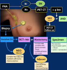 The Radiology Assistant Breast Cancer Staging And Treatment