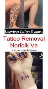 Pin On Tattoo Removal