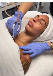 Realza tu piel con Diamond Glow en SKIN REFINE MEDSPA