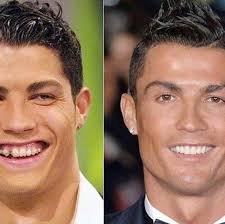 Dr Phil Broughton (@drphilbroughton) • Instagram photos and videos