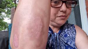 Fundraiser by Latoya Hailstock-Pointer : Support for Kim & Gio after  motorcycle crash.