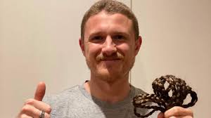 Losing the Locks to Raise Some Dosh