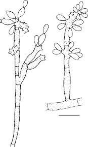 Fonsecaea pedrosoi é um fungo encontrado no solo e nas plantas e árvores em decomposição da américa do sul e central. Fonsecaea Pedrosoi Cbs 271 37 Conidial Apparatus Bar Represents 10 Download Scientific Diagram
