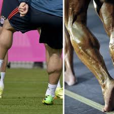 Am samstag, beim 0:1 gegen spanien in madrid, gab der mittelfeldspieler des fc liverpool an seinem 29. Fc Bayern Munchen Star Waden Wie Ein Bodybuilder Fc Bayern