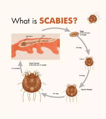 Image result for scabies transmission