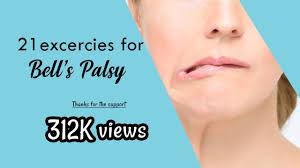 Try to keep the air in your mouth. 21 Exercises For Bell S Palsy Do Not Do These During Complete Palsy Initial Days Youtube