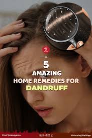 5 Amazing Home Remedies For Dandruff Home Remedies For Dandruff Dandruff Home Remedies