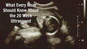 The Anatomy Ultrasound Everything You Should Know