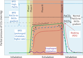 Image result for Colorimetric Capnometry