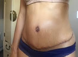 William Wittenborn, MD, Board Certified Plastic Surgeon