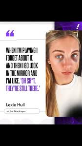 After a rough collision with a Seattle Storm player early in the game,  Lexie Hull still returned to the game and finished with a team high of +31!  She was still rocking
