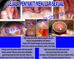 Agen obat herbal bisa kirim barang dulu, transfer setelah barang sampai. Kumpulan Nama Dan Harga Obat Sipilis Raja Singa Herbal Ampuh Di Apotik Kimia Farma Elissabeth