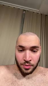Adin Ross Bald Transformation 2023: Taking Over the World