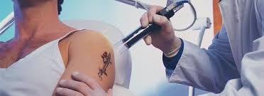 The star is honoring her battle with endometriosis with a new tattoo. Tattoo Removal At The Beauty Studio In County Durham