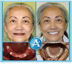 Affinity Dental Care