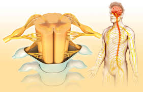 Other times, the pain has nothing to do with the back at all. Radiculopathy Radiculitis And Radicular Pain
