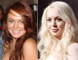 Plastic Surgery Procedures Dallas Cosmetic Surgery A Perfect Body Cosmetic Surgery Celebrity Plastic Surgery Facelift Without Surgery