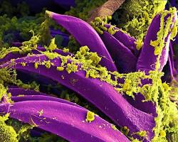 Image of Yersinia pestis bacteria
