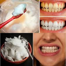 Natural teeth whitening with baking soda and coconut oil