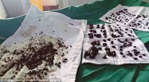 Batu empedu merupakan gangguan kesehatan yang dapat mengganggu kinerja 2. 200 Batu Karang Dalam Badan