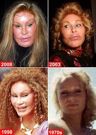 Zila bakarin is an actress, known for setan munafik, kapsul (2015) and no problem (2001). Suntik Botox Mencacatkan Muka Ceritera Si Gadis Biru