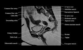 3 enumerate the muscles of true pelvis. Mri Female Pelvis Anatomy Free Mri Sagittal Cross Sectional Anatomy Of Female Pelvis
