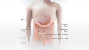 Image result for Colorectal Cancer