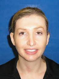 Evan E. Lemley-Fuller, DDS