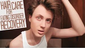 There are two main ways that bulimia causes hair loss. Hair Loss In Eating Disorder Recovery How I Treat Thinning Mens Hair Youtube