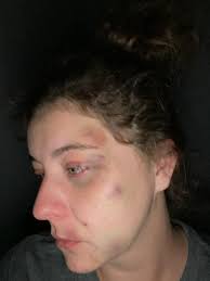 SECOND EDIT: I added more photos of Kyle to this post. He IS responsible  for my sisters death. ** **EDIT: My sisters body has been found. Thank you  for everyone who was